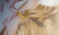 Saç Dökülmesine Çözüm Ankara Saç Kök Hücre Tedavisi