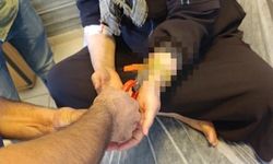 Besni'de kadının bileğine sıkışan altın itfaiye tarafından çıkartıldı