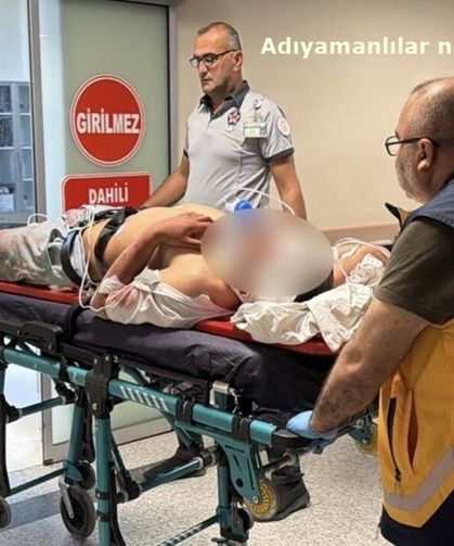 Adıyaman'da motosiklet, elektrik direğine çarptı: 2 yaralı