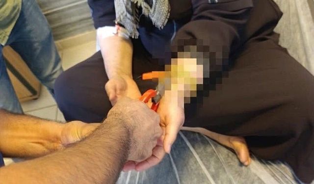 Besni'de kadının bileğine sıkışan altın itfaiye tarafından çıkartıldı