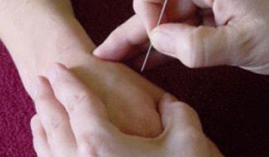 ALTERNATİF Konya Akupuntur Tedavisi Manuel Terapi